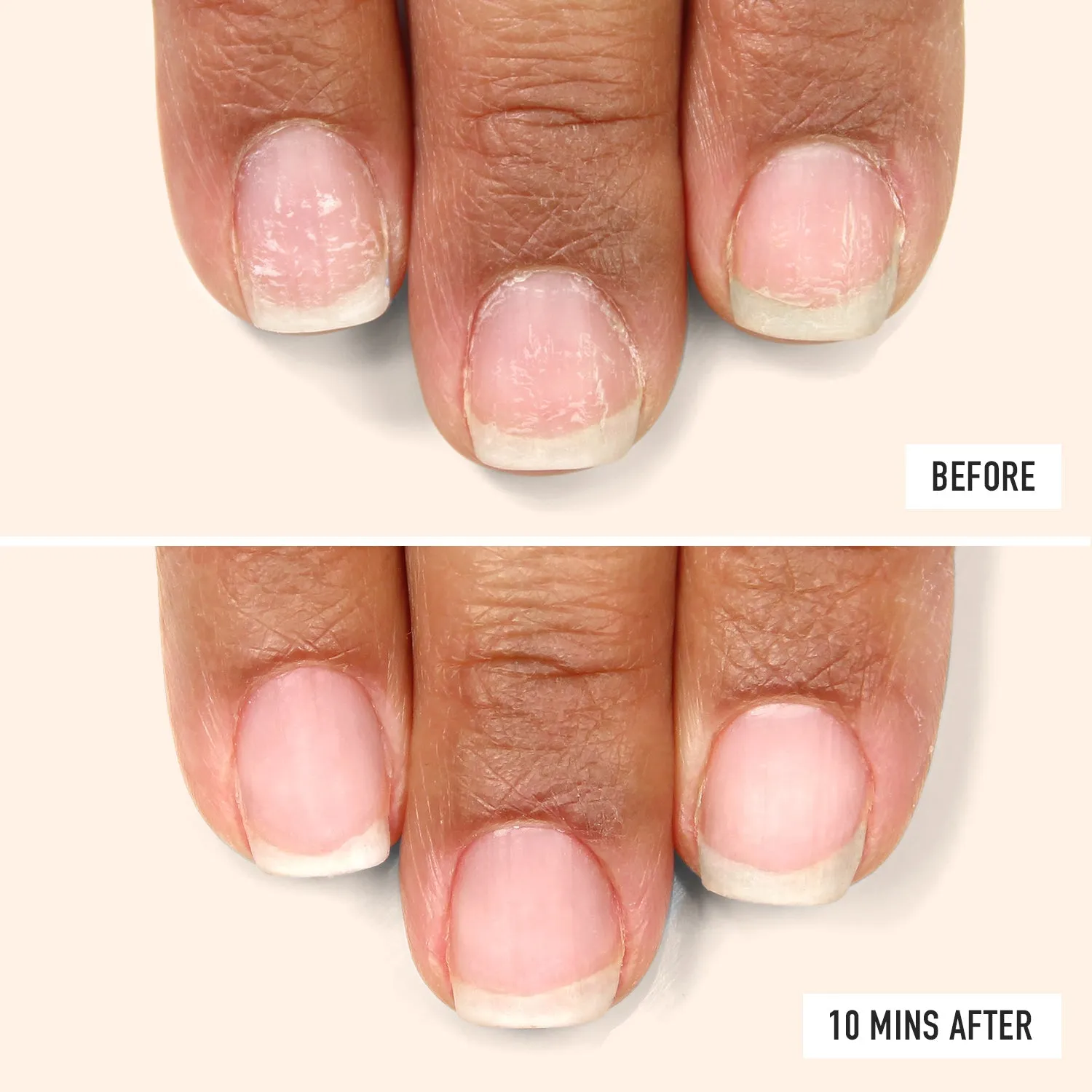 Nail Probiotic Instant Boost (Professional)